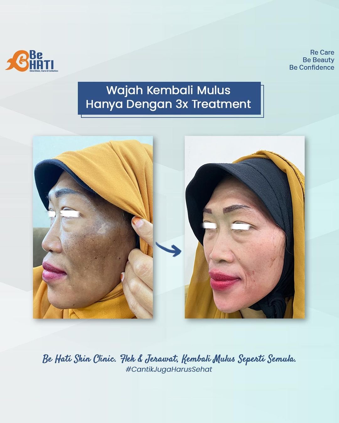 322954488_693310142283947_4321241810417134303_n