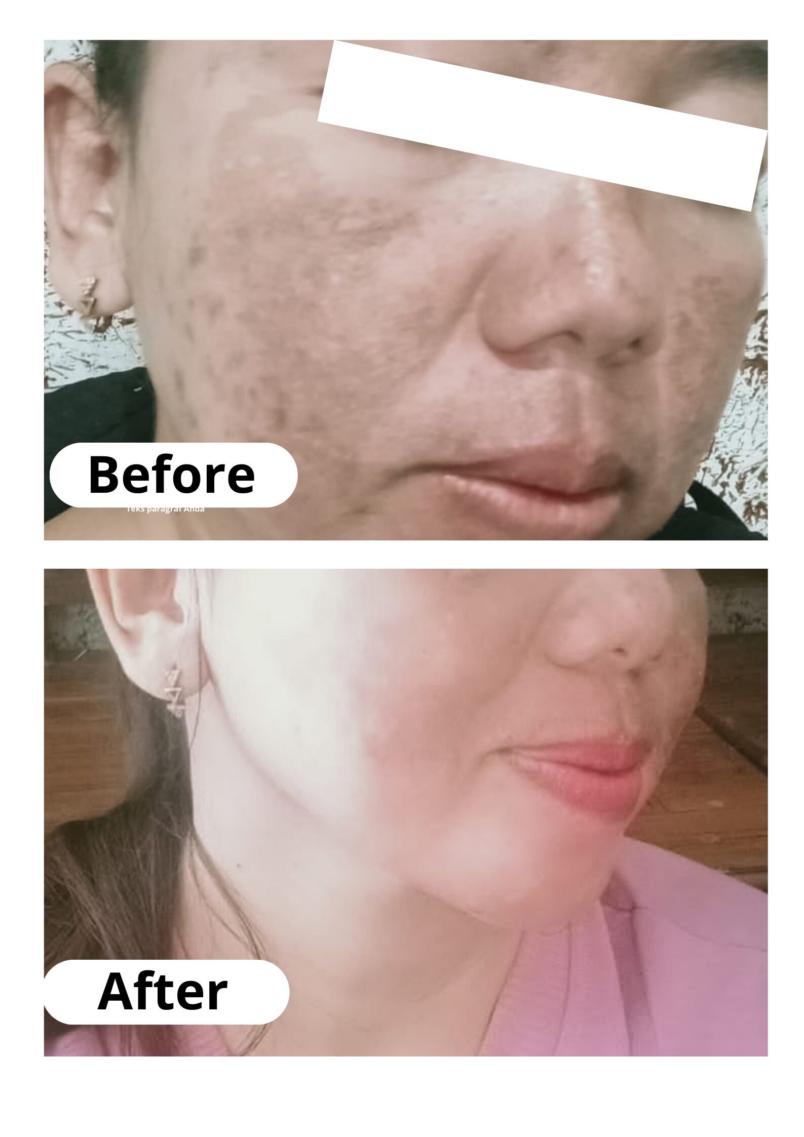 Testimoni Septi Rahayu